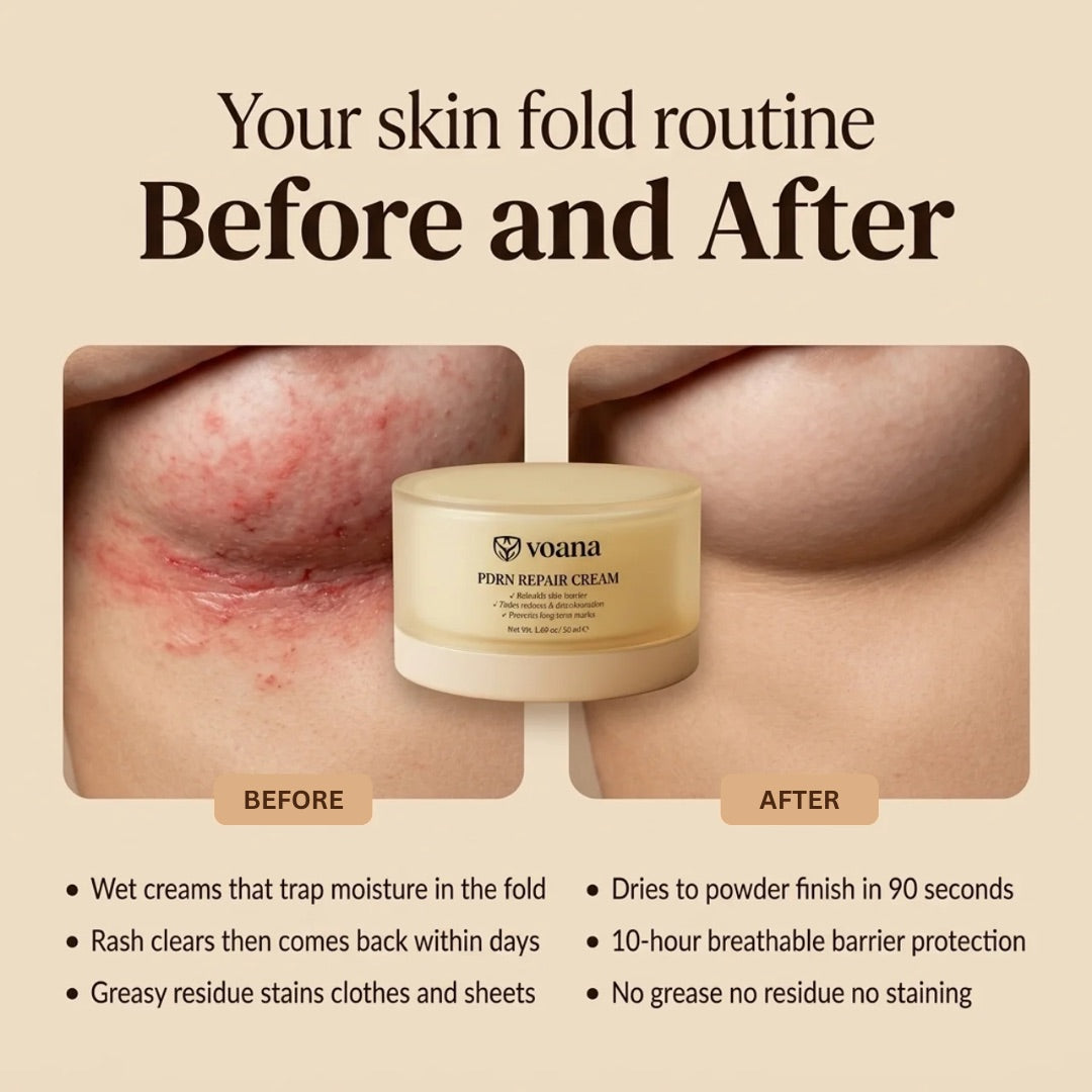 VOANA PDRN Repair Cream skin fold routine before and after